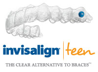 Consider Invisalign Teen vs Traditional Braces