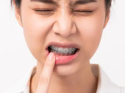 Feeling a Little Sore After Tightening? These Tips Can Help!