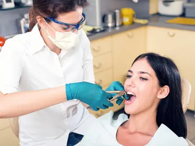 Tooth Extraction